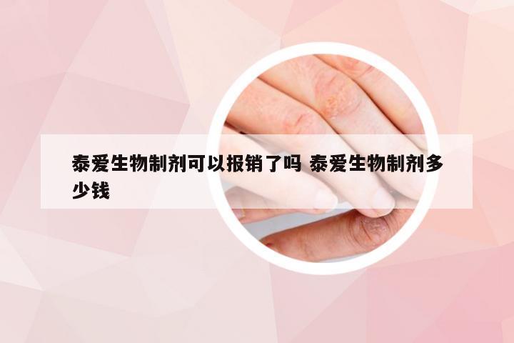 泰爱生物制剂可以报销了吗 泰爱生物制剂多少钱