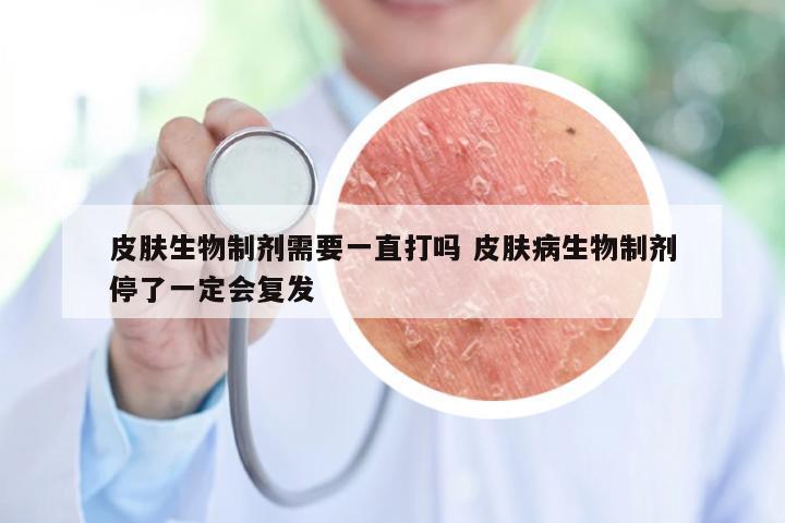 皮肤生物制剂需要一直打吗 皮肤病生物制剂停了一定会复发
