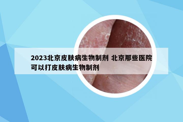 2023北京皮肤病生物制剂 北京那些医院可以打皮肤病生物制剂