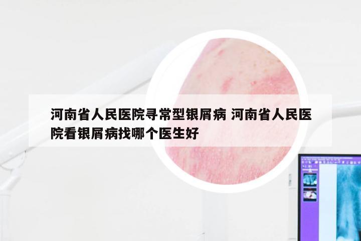 河南省人民医院寻常型银屑病 河南省人民医院看银屑病找哪个医生好