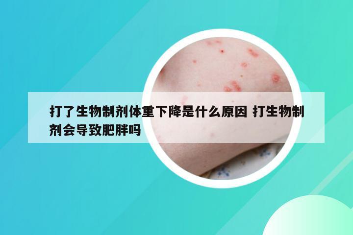 打了生物制剂体重下降是什么原因 打生物制剂会导致肥胖吗