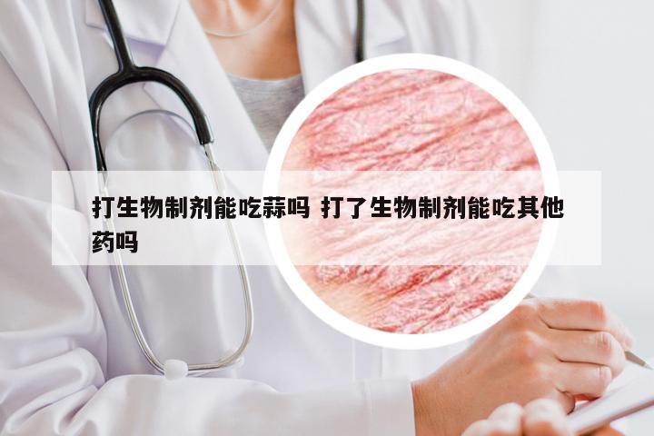 打生物制剂能吃蒜吗 打了生物制剂能吃其他药吗