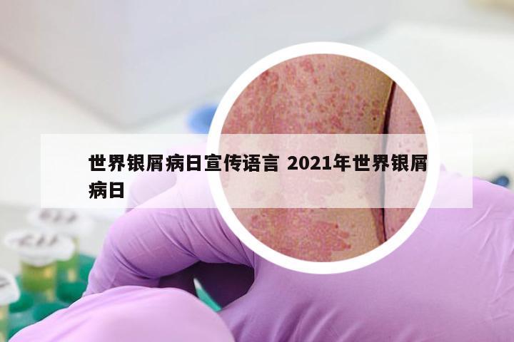 世界银屑病日宣传语言 2021年世界银屑病日
