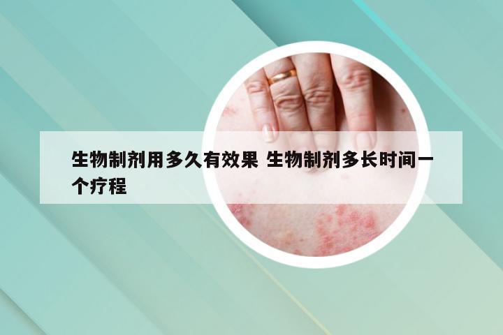 生物制剂用多久有效果 生物制剂多长时间一个疗程