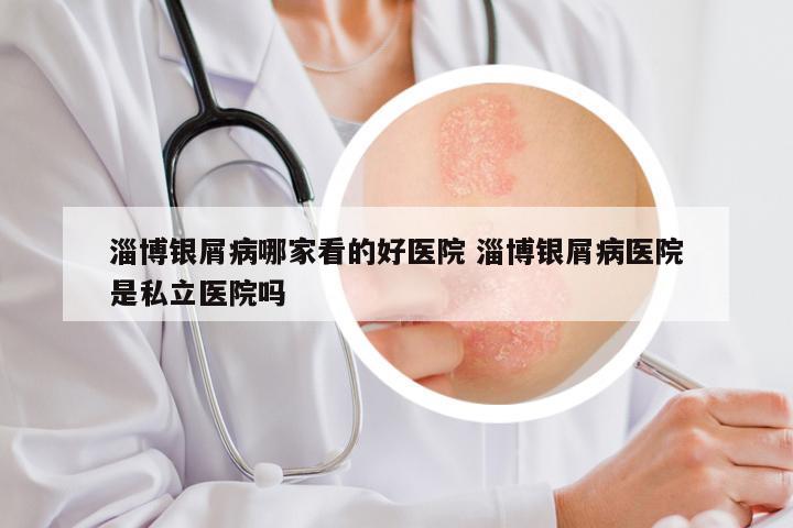 淄博银屑病哪家看的好医院 淄博银屑病医院是私立医院吗