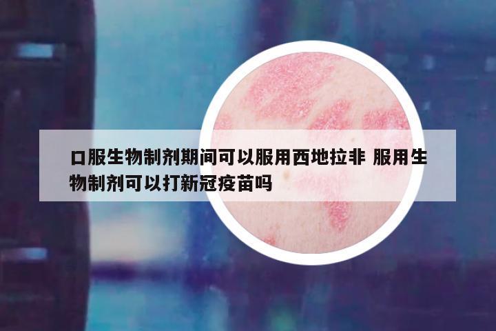 口服生物制剂期间可以服用西地拉非 服用生物制剂可以打新冠疫苗吗