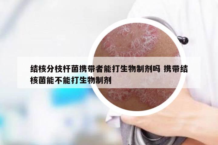 结核分枝杆菌携带者能打生物制剂吗 携带结核菌能不能打生物制剂