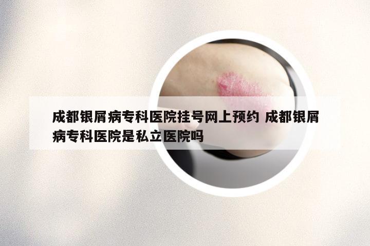 成都银屑病专科医院挂号网上预约 成都银屑病专科医院是私立医院吗
