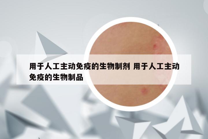 用于人工主动免疫的生物制剂 用于人工主动免疫的生物制品