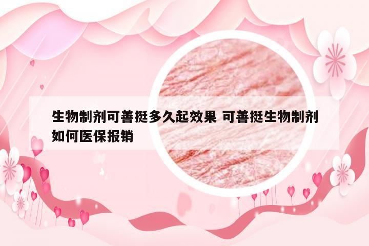 生物制剂可善挺多久起效果 可善挺生物制剂如何医保报销