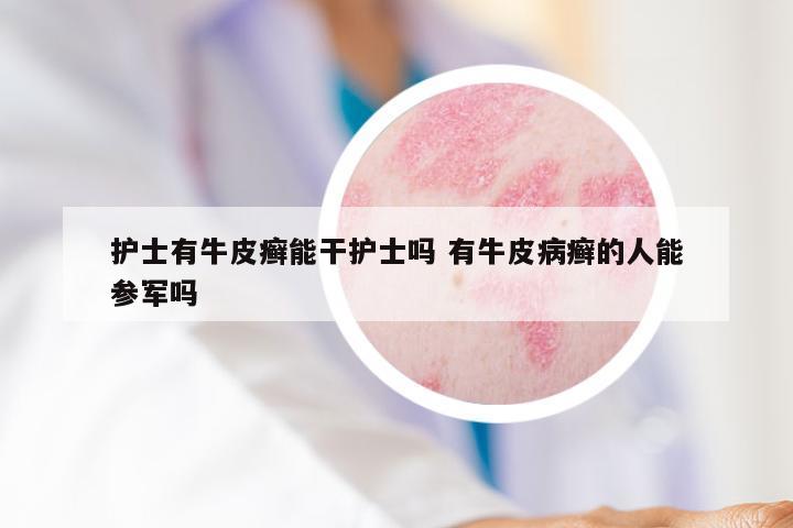 护士有牛皮癣能干护士吗 有牛皮病癣的人能参军吗