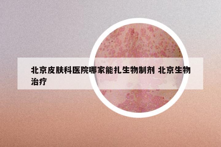 北京皮肤科医院哪家能扎生物制剂 北京生物治疗
