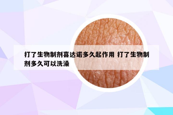 打了生物制剂喜达诺多久起作用 打了生物制剂多久可以洗澡