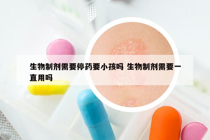 生物制剂需要停药要小孩吗 生物制剂需要一直用吗
