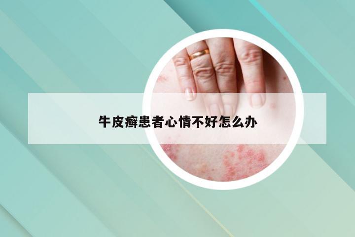 牛皮癣患者心情不好怎么办