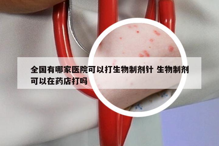 全国有哪家医院可以打生物制剂针 生物制剂可以在药店打吗