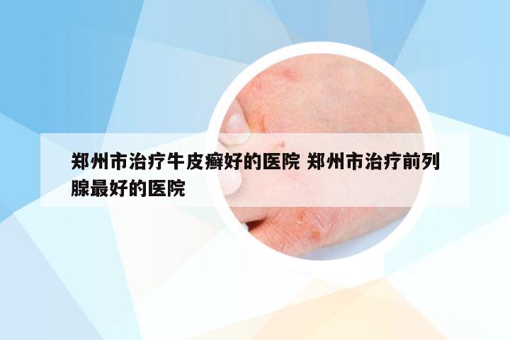 郑州市治疗牛皮癣好的医院 郑州市治疗前列腺最好的医院