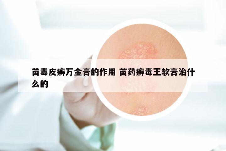 苗毒皮癣万金膏的作用 苗药癣毒王软膏治什么的