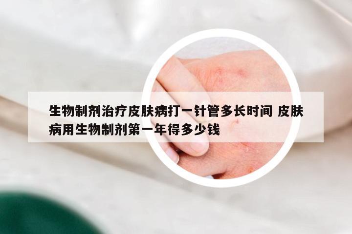 生物制剂治疗皮肤病打一针管多长时间 皮肤病用生物制剂第一年得多少钱