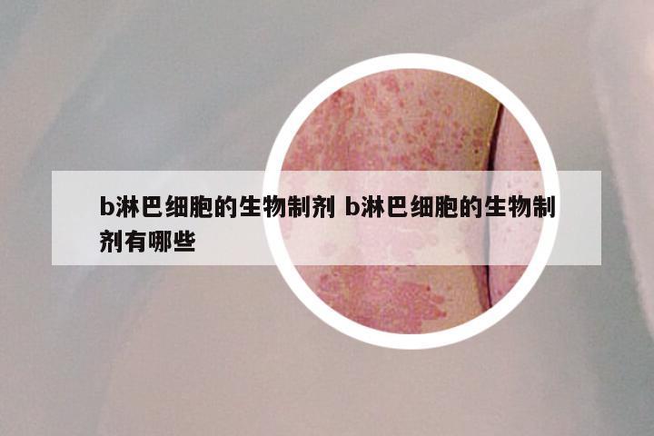 b淋巴细胞的生物制剂 b淋巴细胞的生物制剂有哪些