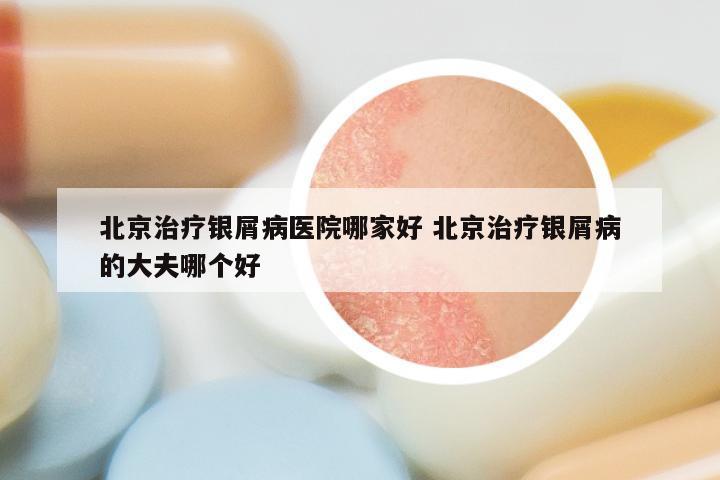 北京治疗银屑病医院哪家好 北京治疗银屑病的大夫哪个好