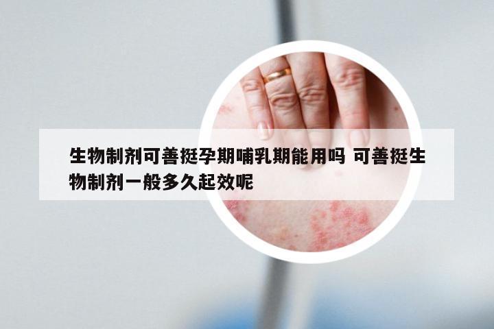 生物制剂可善挺孕期哺乳期能用吗 可善挺生物制剂一般多久起效呢