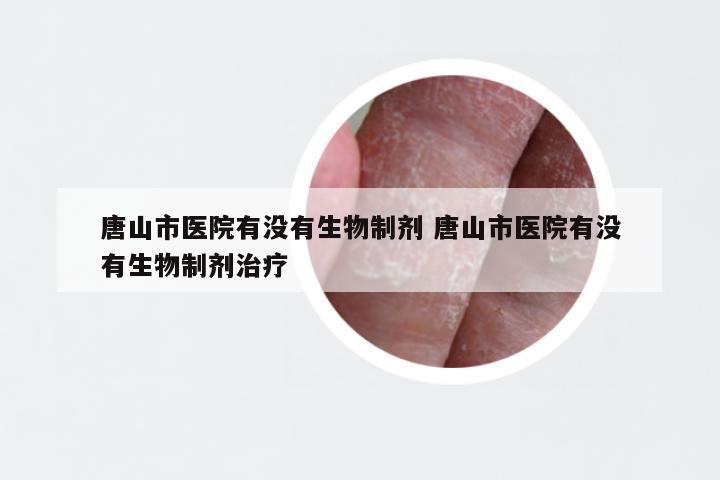唐山市医院有没有生物制剂 唐山市医院有没有生物制剂治疗