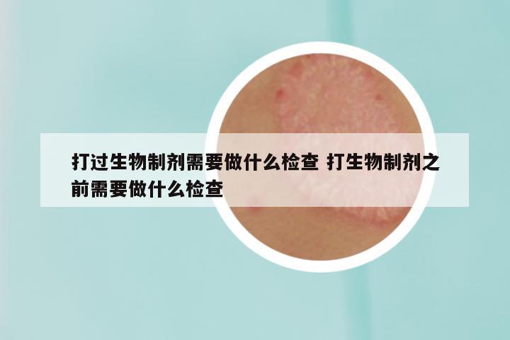 打过生物制剂需要做什么检查 打生物制剂之前需要做什么检查
