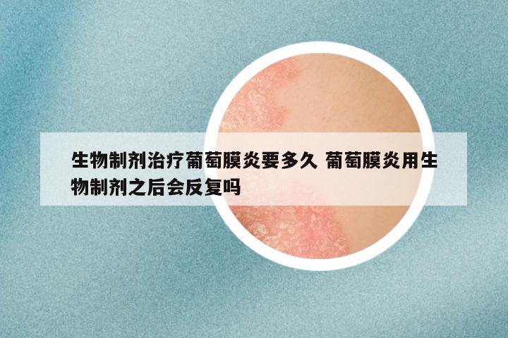 生物制剂治疗葡萄膜炎要多久 葡萄膜炎用生物制剂之后会反复吗