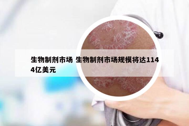 生物制剂市场 生物制剂市场规模将达1144亿美元