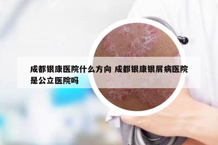 成都银康医院什么方向 成都银康银屑病医院是公立医院吗