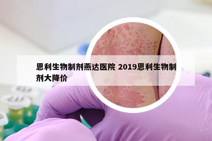 恩利生物制剂燕达医院 2019恩利生物制剂大降价