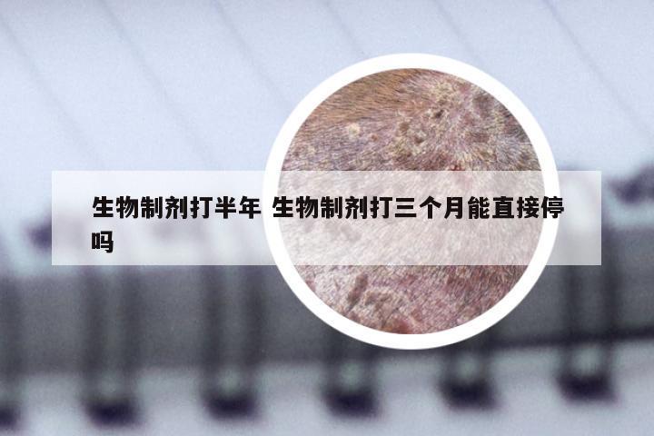 生物制剂打半年 生物制剂打三个月能直接停吗