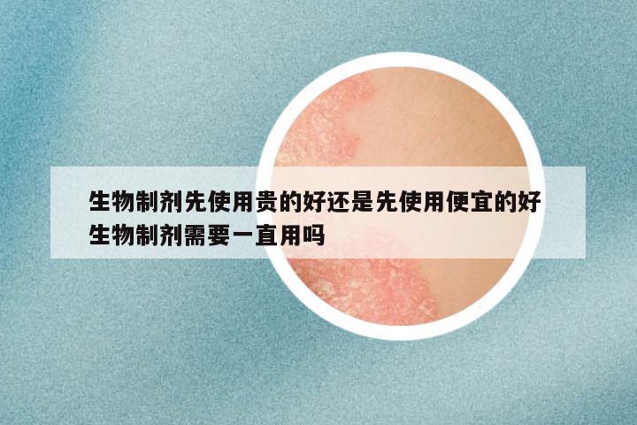 生物制剂先使用贵的好还是先使用便宜的好 生物制剂需要一直用吗