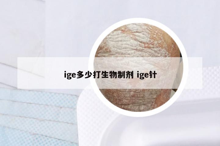 ige多少打生物制剂 ige针