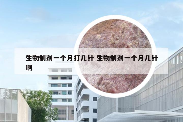 生物制剂一个月打几针 生物制剂一个月几针啊