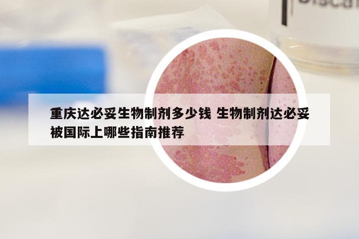 重庆达必妥生物制剂多少钱 生物制剂达必妥被国际上哪些指南推荐