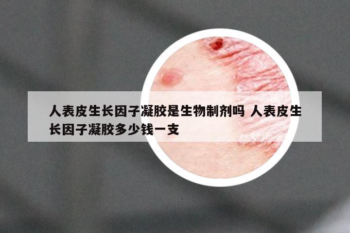 人表皮生长因子凝胶是生物制剂吗 人表皮生长因子凝胶多少钱一支