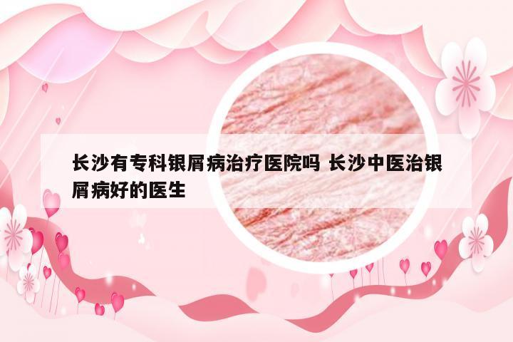 长沙有专科银屑病治疗医院吗 长沙中医治银屑病好的医生