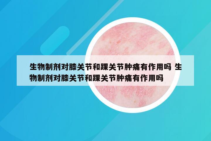 生物制剂对膝关节和踝关节肿痛有作用吗 生物制剂对膝关节和踝关节肿痛有作用吗