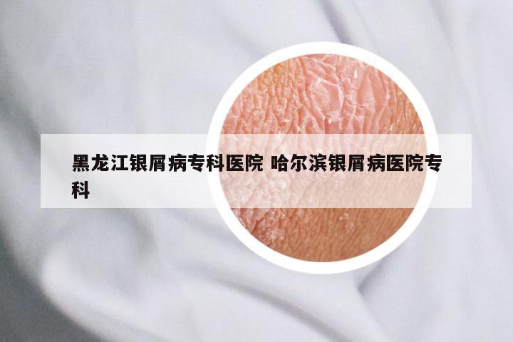 黑龙江银屑病专科医院 哈尔滨银屑病医院专科