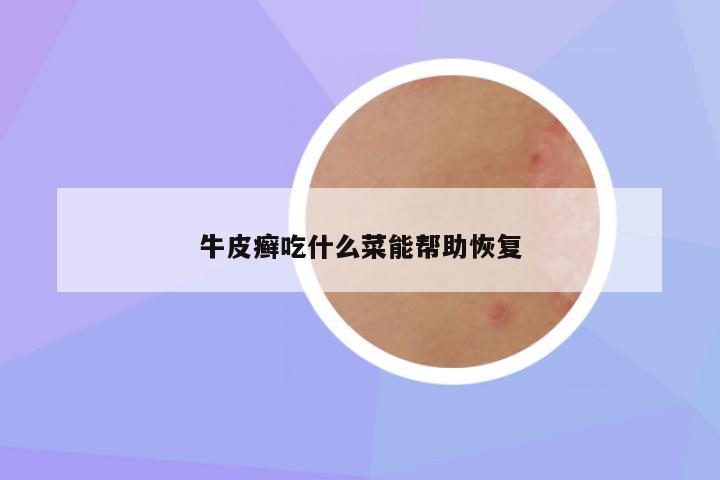 牛皮癣吃什么菜能帮助恢复