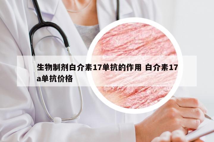 生物制剂白介素17单抗的作用 白介素17a单抗价格