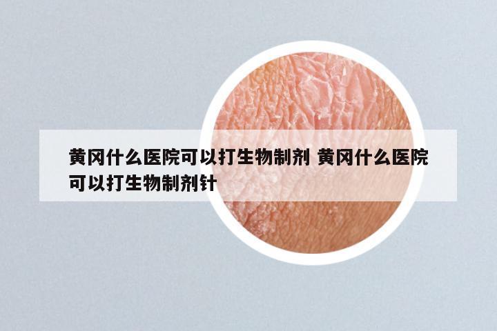 黄冈什么医院可以打生物制剂 黄冈什么医院可以打生物制剂针