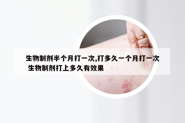 生物制剂半个月打一次,打多久一个月打一次 生物制剂打上多久有效果
