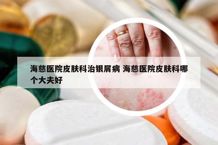 海慈医院皮肤科治银屑病 海慈医院皮肤科哪个大夫好