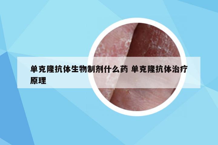 单克隆抗体生物制剂什么药 单克隆抗体治疗原理