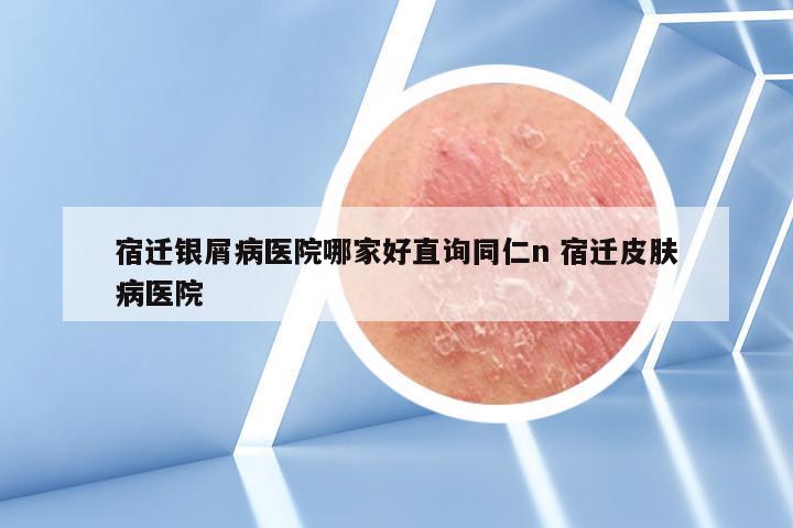 宿迁银屑病医院哪家好直询同仁n 宿迁皮肤病医院
