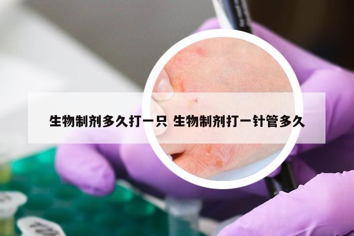 生物制剂多久打一只 生物制剂打一针管多久