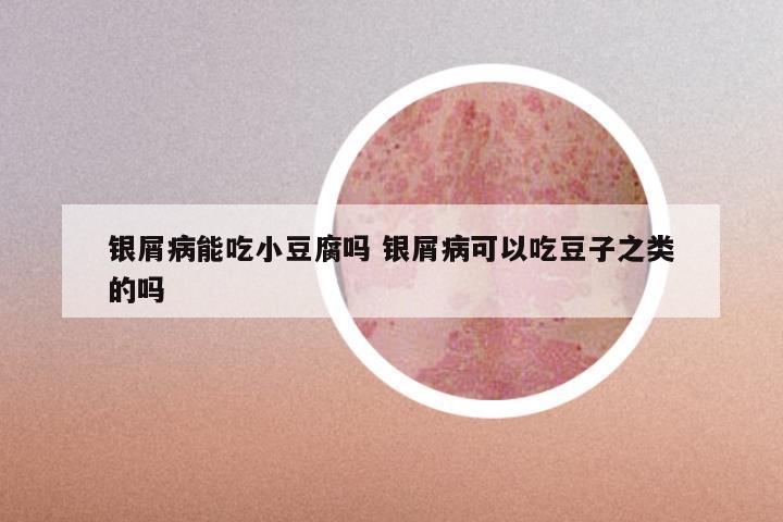 银屑病能吃小豆腐吗 银屑病可以吃豆子之类的吗